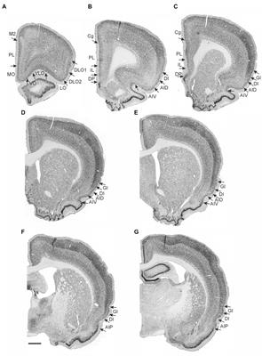 Projections of the insular cortex to orbitofrontal and medial prefrontal cortex: A tracing study in the rat